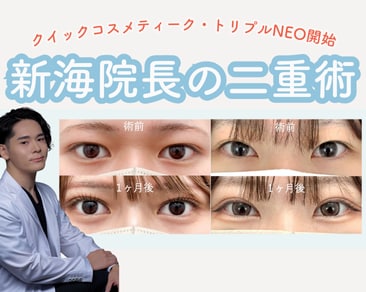 【SBC水戸院】クイックコスメティーク・トリプルNeoが導入‼️二重術するならSBC水戸院へ